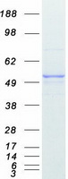 Vitamin D Receptor / VDR Protein - Purified recombinant protein VDR was analyzed by SDS-PAGE gel and Coomassie Blue Staining