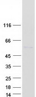 Vitamin D Receptor / VDR Protein - Purified recombinant protein VDR was analyzed by SDS-PAGE gel and Coomassie Blue Staining