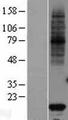 VKORC1 Protein - Western validation with an anti-DDK antibody * L: Control HEK293 lysate R: Over-expression lysate