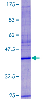 VKORC1 Protein - 12.5% SDS-PAGE of human VKORC1 stained with Coomassie Blue