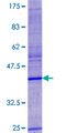 VKORC1 Protein - 12.5% SDS-PAGE of human VKORC1 stained with Coomassie Blue