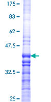 VMD2L3 / BEST3 Protein - 12.5% SDS-PAGE Stained with Coomassie Blue.