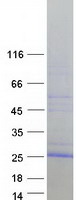 VMO1 Protein - Purified recombinant protein VMO1 was analyzed by SDS-PAGE gel and Coomassie Blue Staining