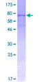 VNN1 Protein - 12.5% SDS-PAGE of human VNN1 stained with Coomassie Blue