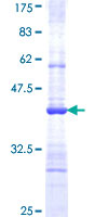 VNN1 Protein - 12.5% SDS-PAGE Stained with Coomassie Blue.