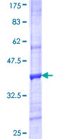VNN3 Protein - 12.5% SDS-PAGE Stained with Coomassie Blue.