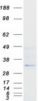 VNN3 Protein - Purified recombinant protein VNN3 was analyzed by SDS-PAGE gel and Coomassie Blue Staining