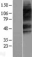 VPAC2 / VIPR2 Protein - Western validation with an anti-DDK antibody * L: Control HEK293 lysate R: Over-expression lysate