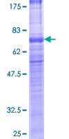 VPAC2 / VIPR2 Protein - 12.5% SDS-PAGE of human VIPR2 stained with Coomassie Blue