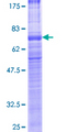 VPAC2 / VIPR2 Protein - 12.5% SDS-PAGE of human VIPR2 stained with Coomassie Blue