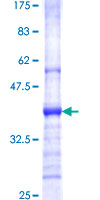 VPREB3 Protein - 12.5% SDS-PAGE Stained with Coomassie Blue.