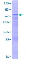 VPS11 Protein - 12.5% SDS-PAGE of human VPS11 stained with Coomassie Blue