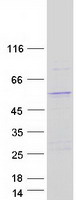 VPS13B Protein - Purified recombinant protein VPS13B was analyzed by SDS-PAGE gel and Coomassie Blue Staining