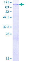 VPS16 Protein - 12.5% SDS-PAGE of human VPS16 stained with Coomassie Blue