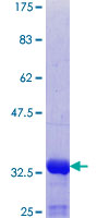VPS16 Protein - 12.5% SDS-PAGE Stained with Coomassie Blue.
