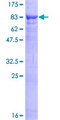VPS18 Protein - 12.5% SDS-PAGE of human VPS18 stained with Coomassie Blue
