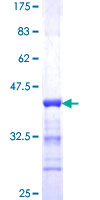 VPS18 Protein - 12.5% SDS-PAGE Stained with Coomassie Blue.