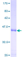 VPS25 Protein - 12.5% SDS-PAGE of human MGC10540 stained with Coomassie Blue