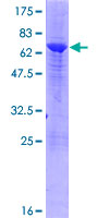 VPS26A / VPS26 Protein - 12.5% SDS-PAGE of human VPS26A stained with Coomassie Blue