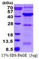 VPS26A / VPS26 Protein