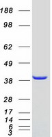 VPS26A / VPS26 Protein - Purified recombinant protein VPS26A was analyzed by SDS-PAGE gel and Coomassie Blue Staining
