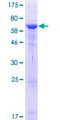 VPS26B Protein - 12.5% SDS-PAGE of human VPS26B stained with Coomassie Blue