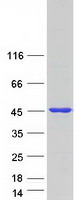 VPS26B Protein - Purified recombinant protein VPS26B was analyzed by SDS-PAGE gel and Coomassie Blue Staining