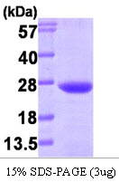 VPS28 Protein