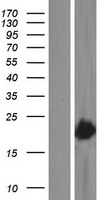 VPS29 Protein - Western validation with an anti-DDK antibody * L: Control HEK293 lysate R: Over-expression lysate