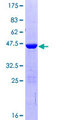 VPS29 Protein - 12.5% SDS-PAGE of human VPS29 stained with Coomassie Blue
