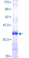 VPS29 Protein - 12.5% SDS-PAGE Stained with Coomassie Blue.