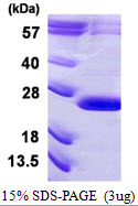 VPS29 Protein