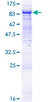 VPS33B Protein - 12.5% SDS-PAGE of human VPS33B stained with Coomassie Blue