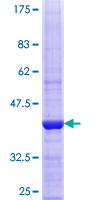 VPS33B Protein - 12.5% SDS-PAGE Stained with Coomassie Blue.