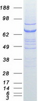 VPS33B Protein - Purified recombinant protein VPS33B was analyzed by SDS-PAGE gel and Coomassie Blue Staining