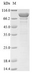 VPS35 Protein - (Tris-Glycine gel) Discontinuous SDS-PAGE (reduced) with 5% enrichment gel and 15% separation gel.