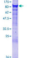 VPS35 Protein - 12.5% SDS-PAGE of human VPS35 stained with Coomassie Blue