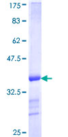 VPS35 Protein - 12.5% SDS-PAGE Stained with Coomassie Blue.