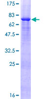 VPS36 Protein - 12.5% SDS-PAGE of human VPS36 stained with Coomassie Blue