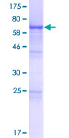 VPS37A Protein - 12.5% SDS-PAGE of human VPS37A stained with Coomassie Blue