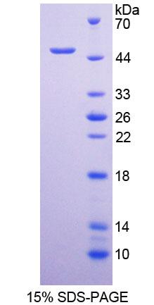 VPS37A Protein - Recombinant  Hepatocellular Carcinoma Related Protein 1 By SDS-PAGE