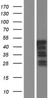 VPS37C Protein - Western validation with an anti-DDK antibody * L: Control HEK293 lysate R: Over-expression lysate