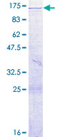 VPS39 Protein - 12.5% SDS-PAGE of human VPS39 stained with Coomassie Blue
