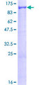 VPS41 Protein - 12.5% SDS-PAGE of human VPS41 stained with Coomassie Blue