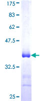 VPS41 Protein - 12.5% SDS-PAGE Stained with Coomassie Blue.