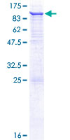 VPS45 Protein - 12.5% SDS-PAGE of human VPS45 stained with Coomassie Blue