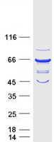 VPS45 Protein - Purified recombinant protein VPS45 was analyzed by SDS-PAGE gel and Coomassie Blue Staining