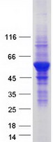 VPS4A Protein - Purified recombinant protein VPS4A was analyzed by SDS-PAGE gel and Coomassie Blue Staining