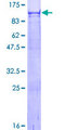 VPS52 / SACM2L Protein - 12.5% SDS-PAGE of human VPS52 stained with Coomassie Blue