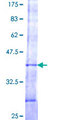 VPS52 / SACM2L Protein - 12.5% SDS-PAGE Stained with Coomassie Blue.